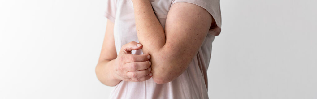 types of skin rashes